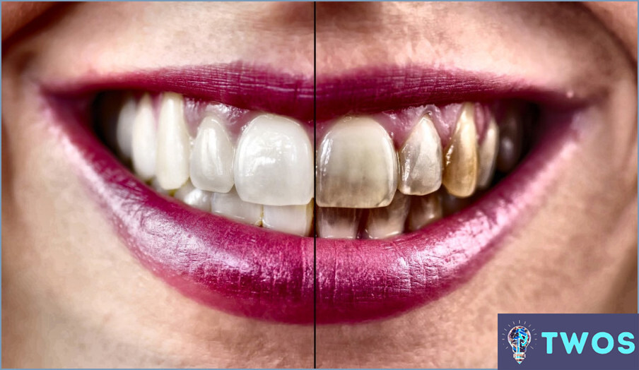 Cómo limpiar los dientes de oro con bicarbonato de sodio?